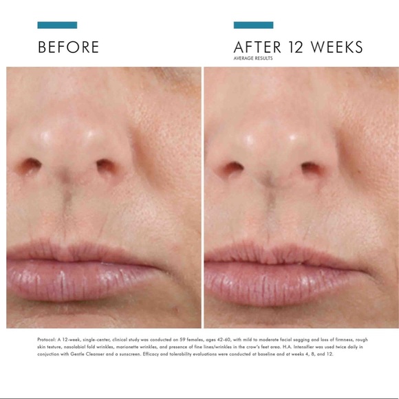 SKINCEUTICALS HA INTENSIFIER BRAND NEW SEALED IN BOX - Picture 4 of 6